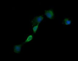 Monoclonal Mouse anti-Human EGFR Antibody (clone OTI2G8, IF, WB)