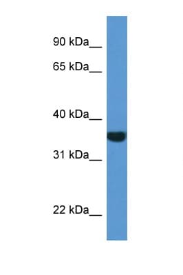 NQO1 Antibody (C-Terminus)