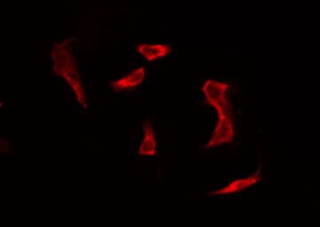 STAT5A Antibody