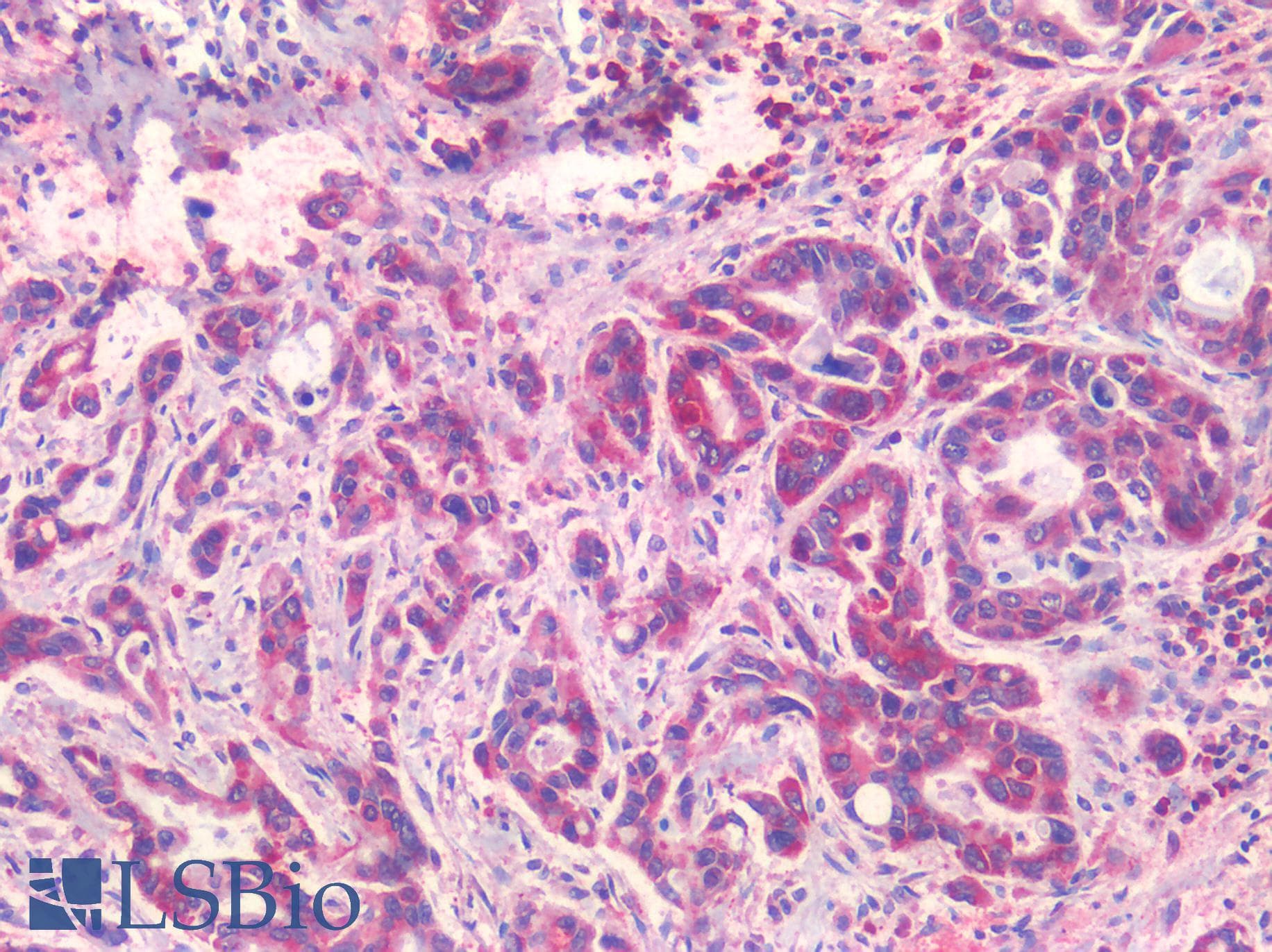 PathPlus™ EPHB2 / EPH Receptor B2 Antibody (Internal)
