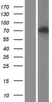 TOP1MT Protein (Over-Expression Lysate Myc-DDK (Flag))