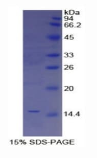 Human TFF2 / SP Protein (Recombinant His)