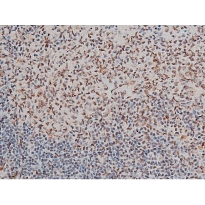 GATA1 Antibody (phospho-Ser142)