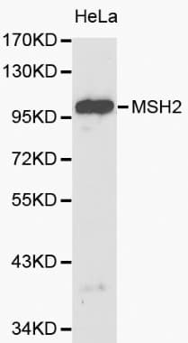 MSH2 Antibody