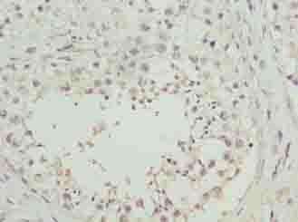 Polyclonal Rabbit anti-Human C8orf51 Antibody (IHC)