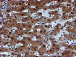 PSMA6 Antibody (clone OTI5H3)