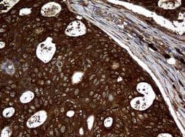NME1 / NM23 Antibody (clone OTI7D6)
