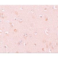 NLRP5 / NALP5 Antibody
