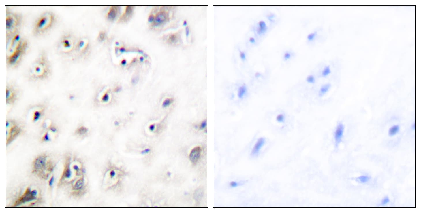 IAPP / Amylin Antibody (aa1-50)