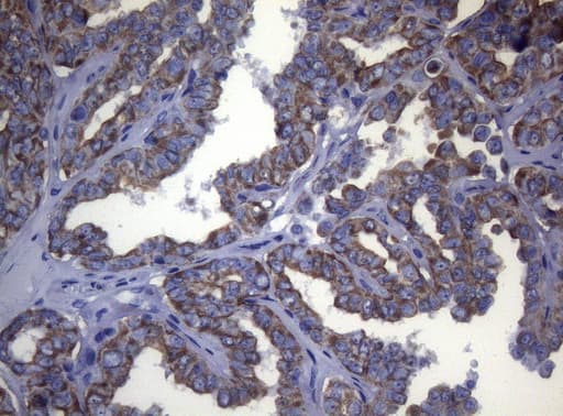 KRT18 / CK18 / Cytokeratin 18 Antibody (aa69-372, clone OTI5E4, Carrier-free)