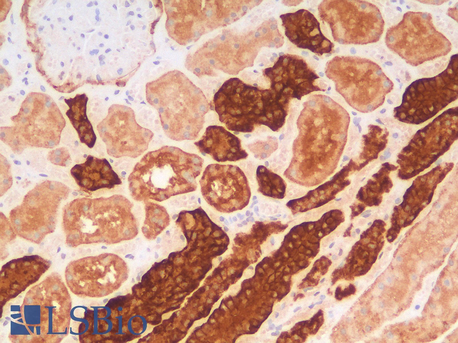 IHC-plus™ Recombinant Monoclonal Rabbit anti-Human EPCAM Antibody (clone EGP40/2041R, aa100-224, IHC, WB)