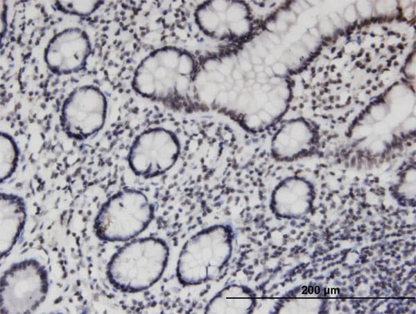 Monoclonal Mouse anti-Human PCGF3 Antibody (clone 1F1, IHC)