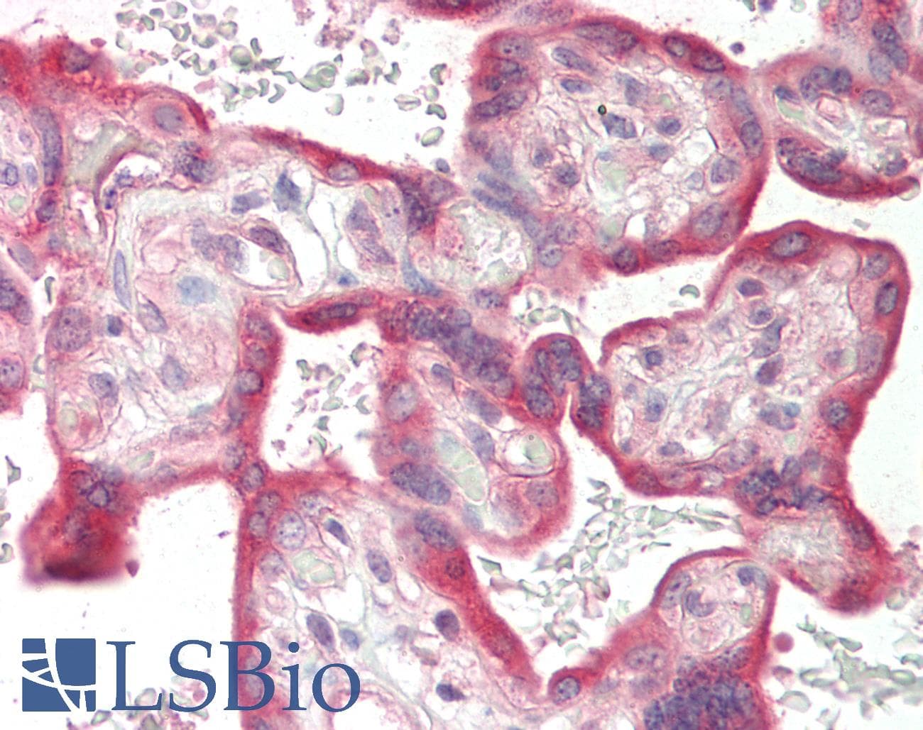 Polyclonal Rabbit anti-Human CRH / CRF Antibody (C-Terminus, IHC, WB)