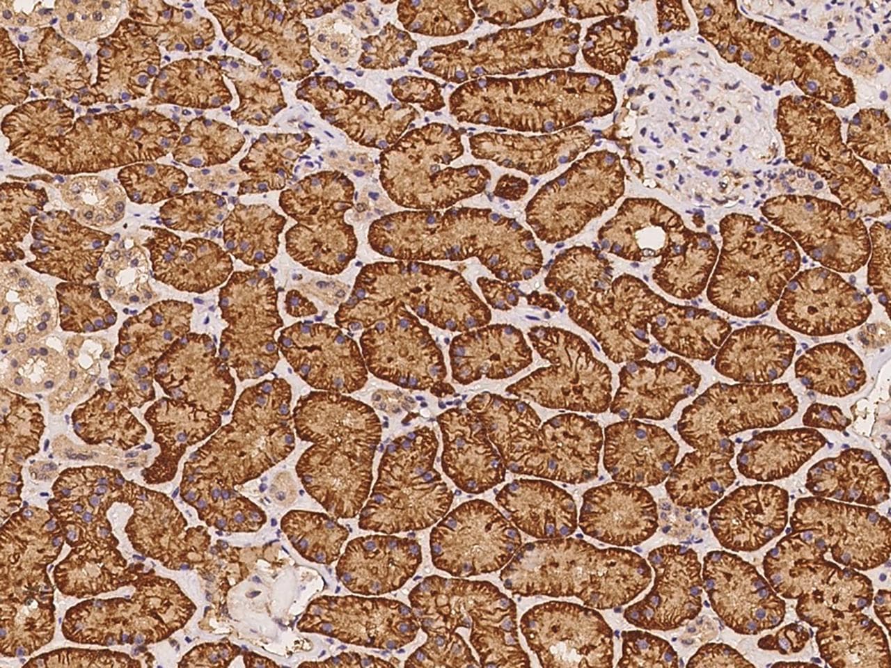 Polyclonal Rabbit anti-Human KIAA0825 Antibody (IHC)