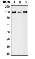 Polyclonal Rabbit anti-Human EPH Receptor B1+B2 Antibody (phospho-Tyr594/Tyr604, IF, WB)