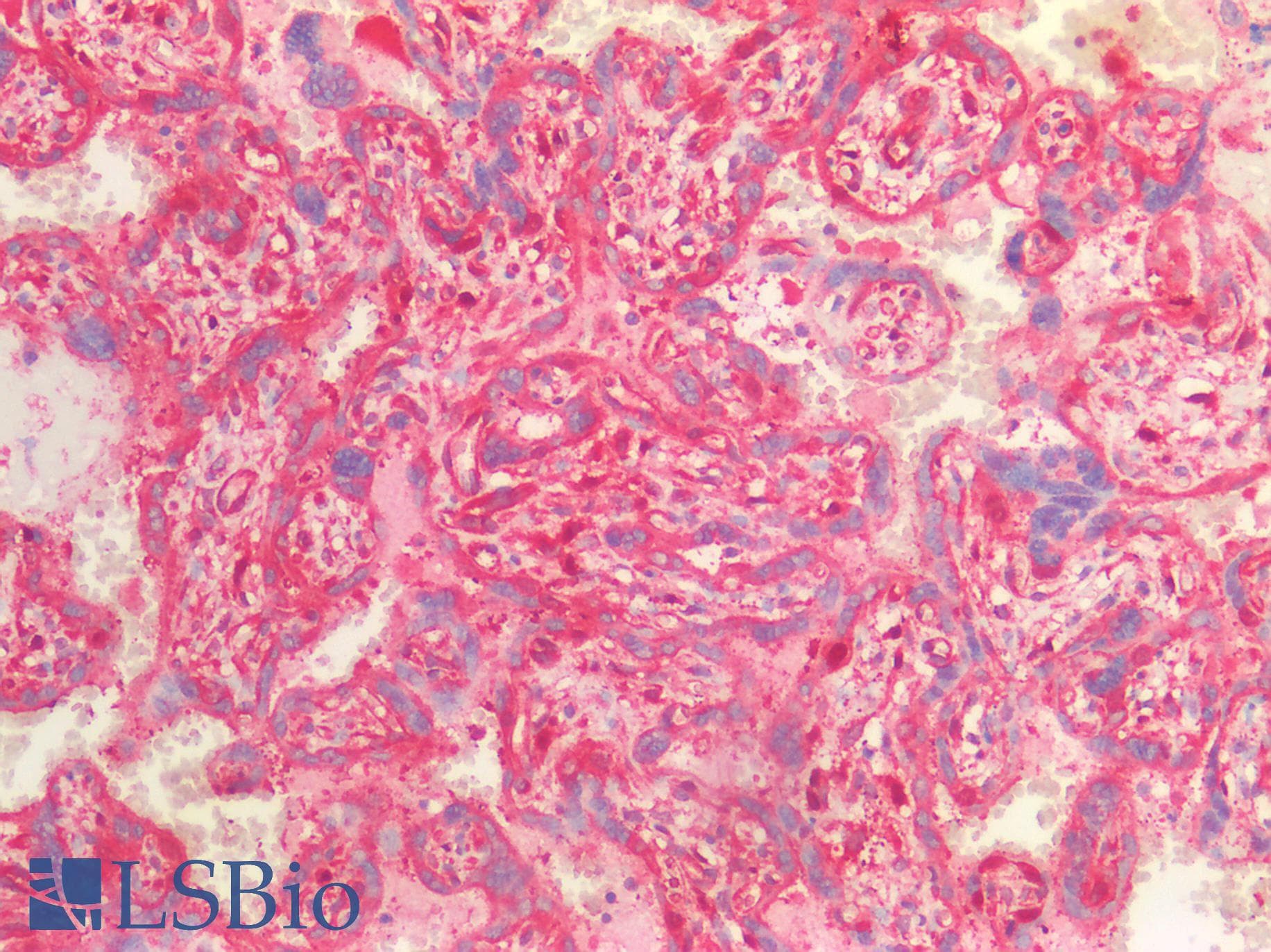 PathPlus™ CTNNB1 / Beta Catenin Antibody