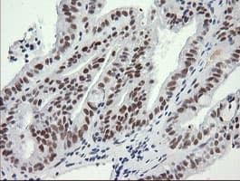 SOLO / SESTD1 Antibody (clone OTI2E7)