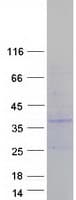 Human PIGX Protein (Recombinant Myc-DDK (Flag))