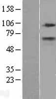 CPT1A Protein (Over-Expression Lysate Myc-DDK (Flag))