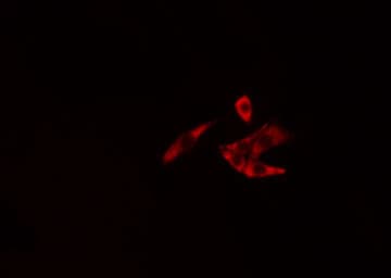 NEDL2 / HECW2 Antibody