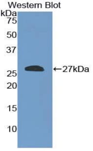 SHC2 / SLI Antibody (aa98-302)