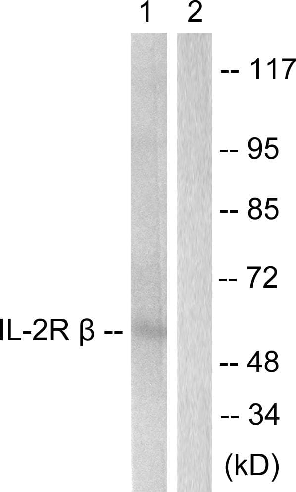Polyclonal Rabbit anti-Human IL2RB / CD122 Antibody (p364, IF, WB)