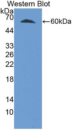 TERT / Telomerase Antibody (aa642-974, FITC)