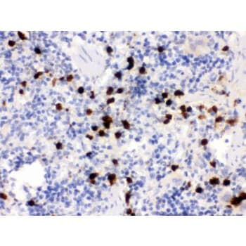 S100A9 / MRP14 Antibody (aa2-113)
