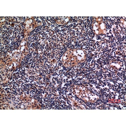 KRT19 / CK19 / Cytokeratin 19 Antibody (321-370 aa, C-terminal)