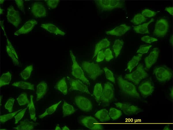 Monoclonal Mouse anti-Human RPL13 / Ribosomal Protein L13 Antibody (clone 3F6, IF, WB)