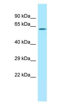RDX / Radixin Antibody (aa493-542)
