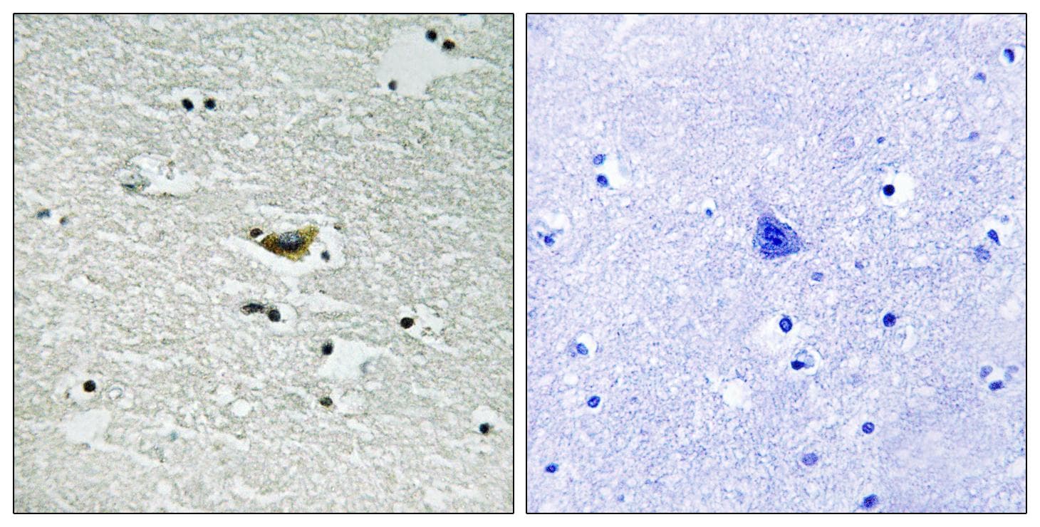 Polyclonal Rabbit anti-Human CSNK1A1 / CK1 Alpha Antibody (phospho-Tyr294, IHC, WB)