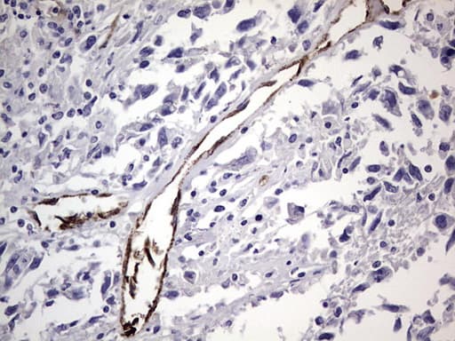 VWF / Von Willebrand Factor Antibody (aa764-1263, clone OTI7G3, Carrier-free)