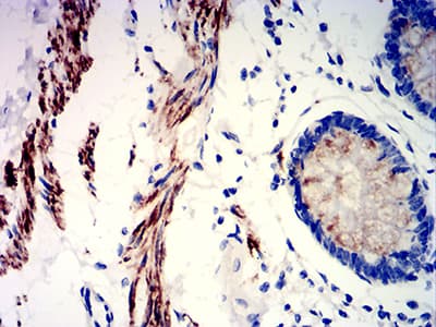 PRKAG3 / AMPK Gamma 3 Antibody (clone 2C7A7)