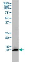 FKBP1A / FKBP12 Antibody (clone 1E5-A12)