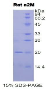 Rat A2M / Alpha-2-Macroglobulin Protein (Recombinant His)