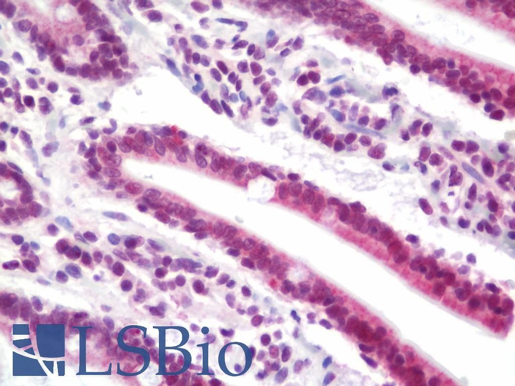 IHC-plus™ Polyclonal Rabbit anti-Human NCOA2 / TIF2 Antibody (aa1400-C-term, IHC)