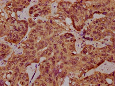 SPINK9 Antibody
