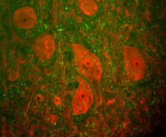 UCHL1 / PGP9.5 Antibody