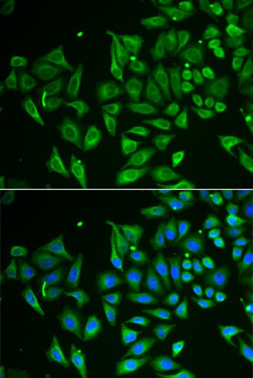 CLEC3B / Tetranectin Antibody
