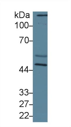 CALR / Calreticulin Antibody (aa196-310, APC)
