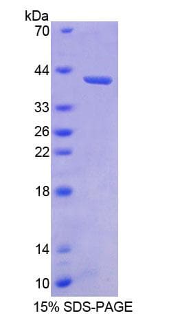 Human BMP3 Protein (Recombinant His-GST)