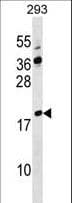 Polyclonal Rabbit anti-Human LYZL4 Antibody (aa37-63, WB)