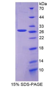 Bovine CRP / C-Reactive Protein (Recombinant His-T7)