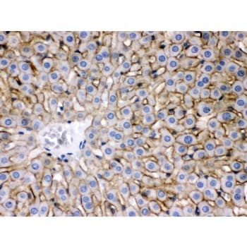 Polyclonal Rabbit anti-Mouse SLC10A1 / NTCP Antibody (aa296-336, IHC, WB)
