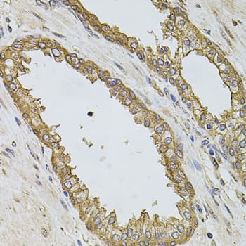 PIK3CA / PI3K Alpha Antibody