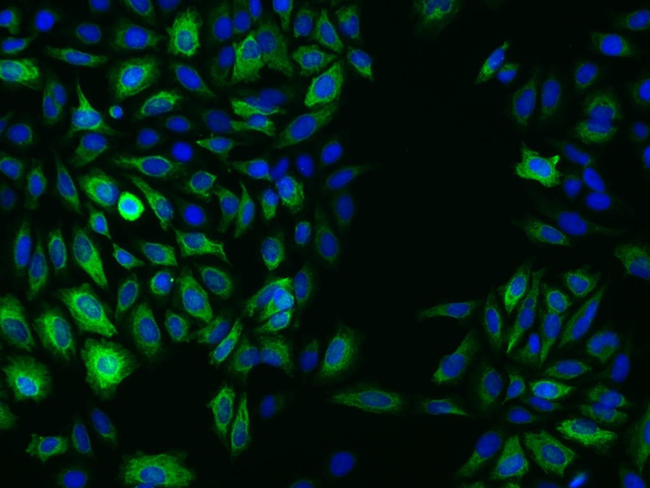 Polyclonal Rabbit anti-Human KRT17 / CK17 / Cytokeratin 17 Antibody (IHC, IF)