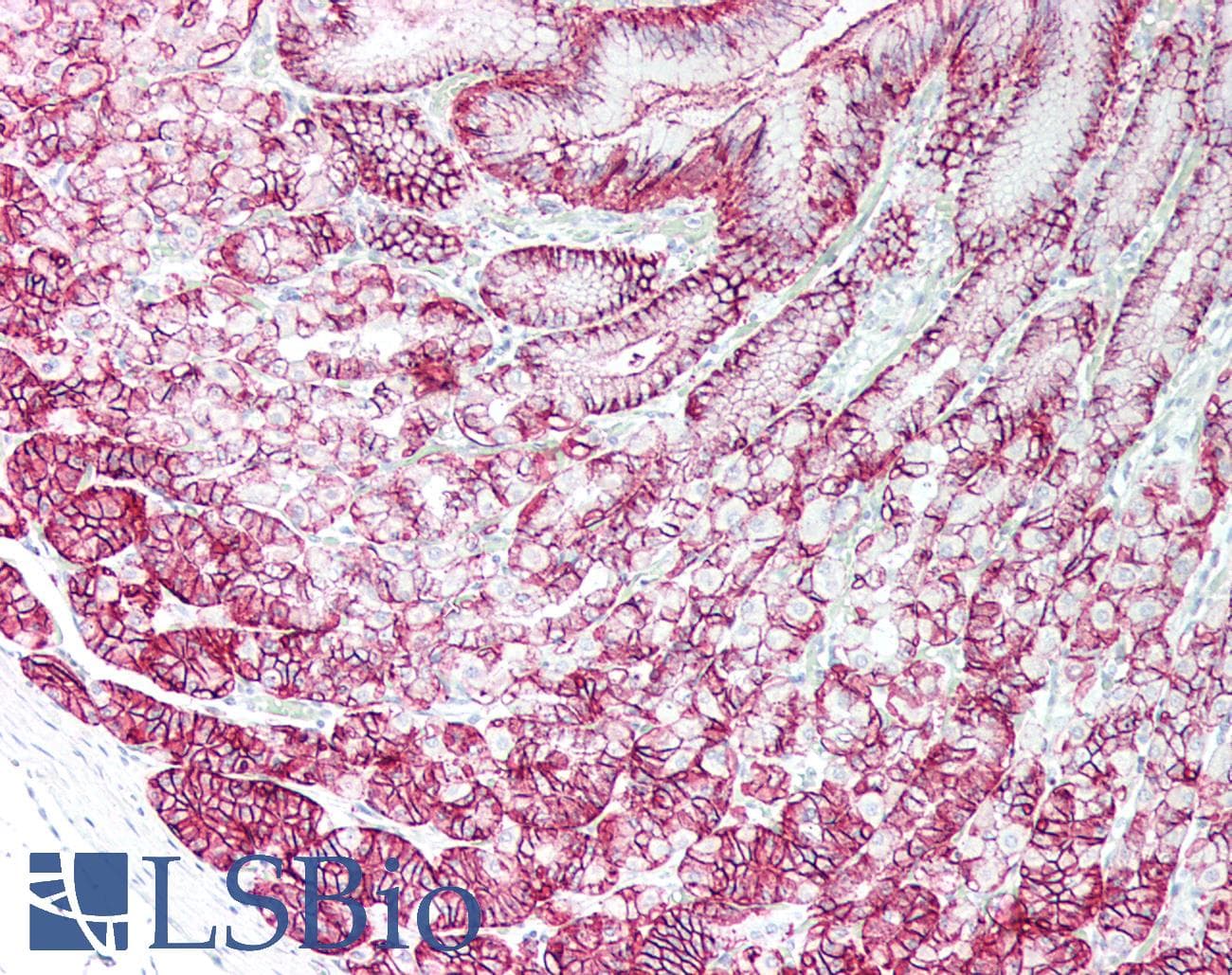 PathPlus™ Monoclonal Mouse anti-Human CLDN18 / Claudin 18 Antibody (IHC)