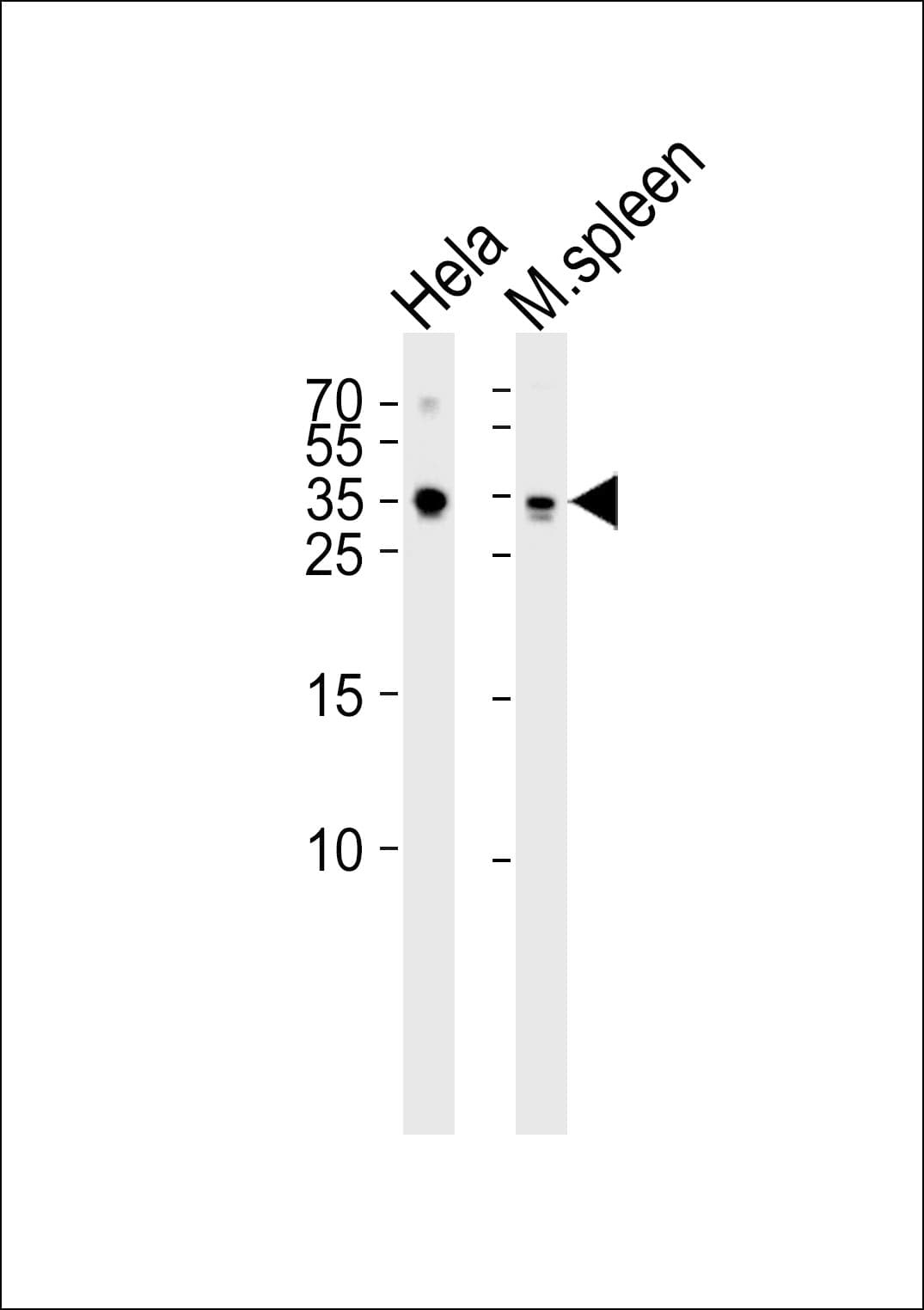 TCF21 / Epicardin Antibody (aa144-173)