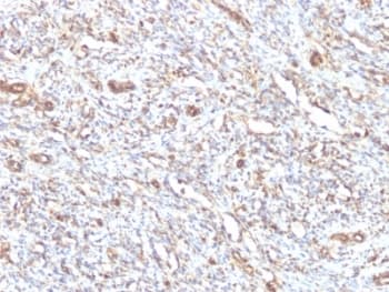 Vimentin Antibody (clone VM1170)
